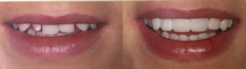 Dr Amanda J. Yu - Dentist Find 4