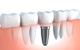 Jones Dental - thumb 13