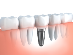 Jones Dental - Dentist Search 34