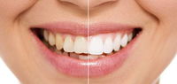 Newcastle Dental Care