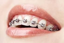 Dental Centre Maleny - Dentist Search 4