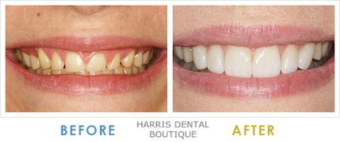 Harris Dental Boutique - Dentist Find 4