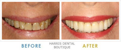 Harris Dental Boutique - Dentist Find 5
