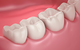 Coastal Dental Implants - thumb 0
